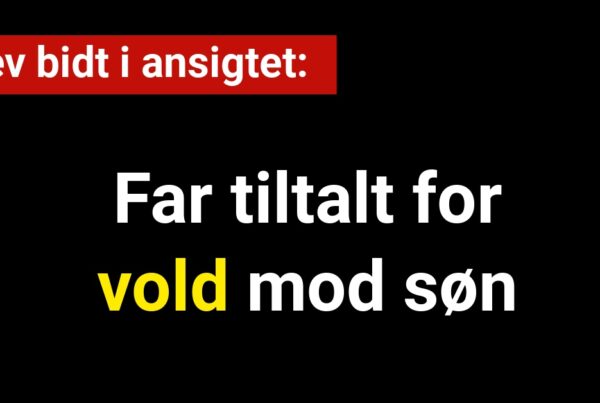 Far tiltalt for vold mod søn: Blev bidt i ansigtet
