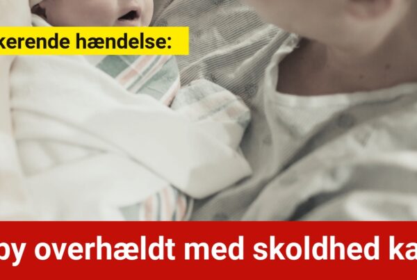 Chokerende hændelse: Baby overhældt med skoldhed kaffe