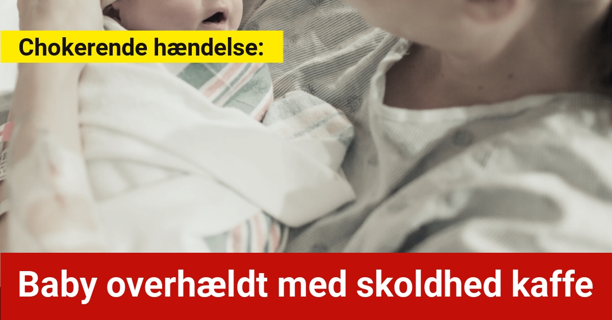 Chokerende hændelse: Baby overhældt med skoldhed kaffe