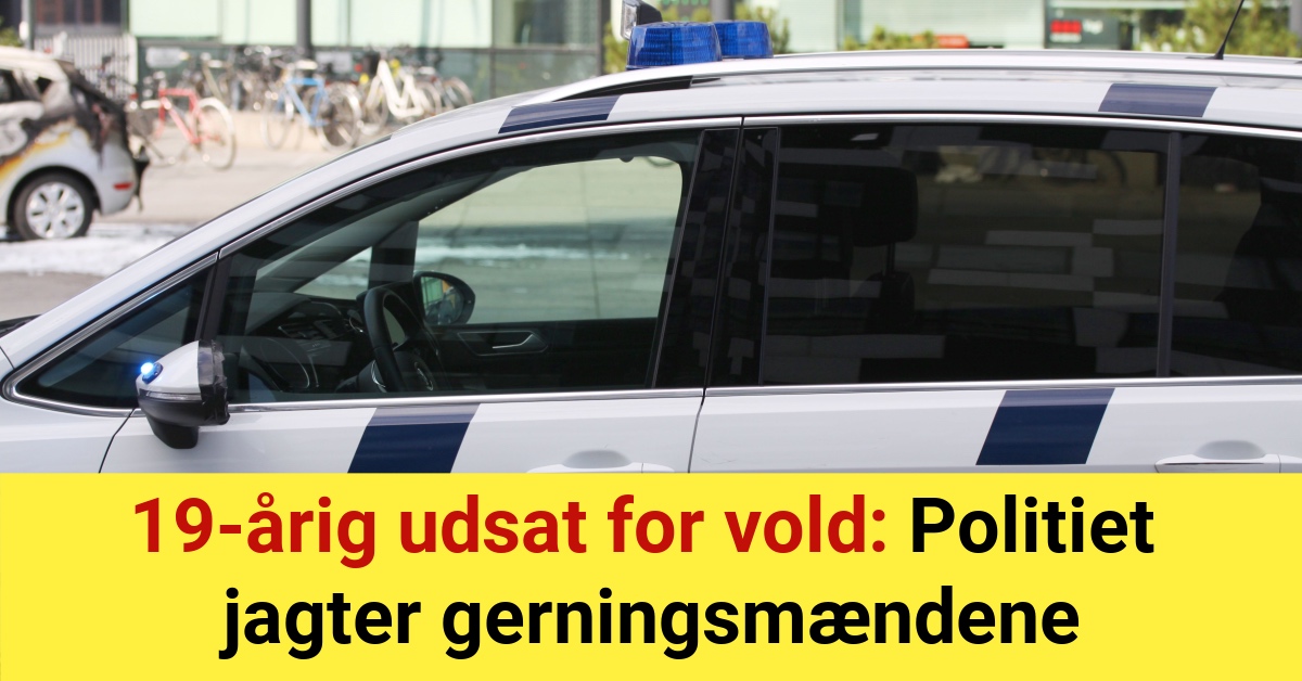 19-årig udsat for vold: Politiet jagter gerningsmændene