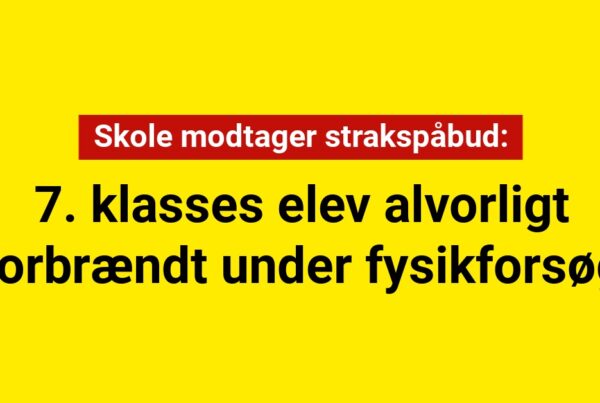 Skole modtager strakspåbud: 7. klasses elev alvorligt forbrændt under fysikforsøg