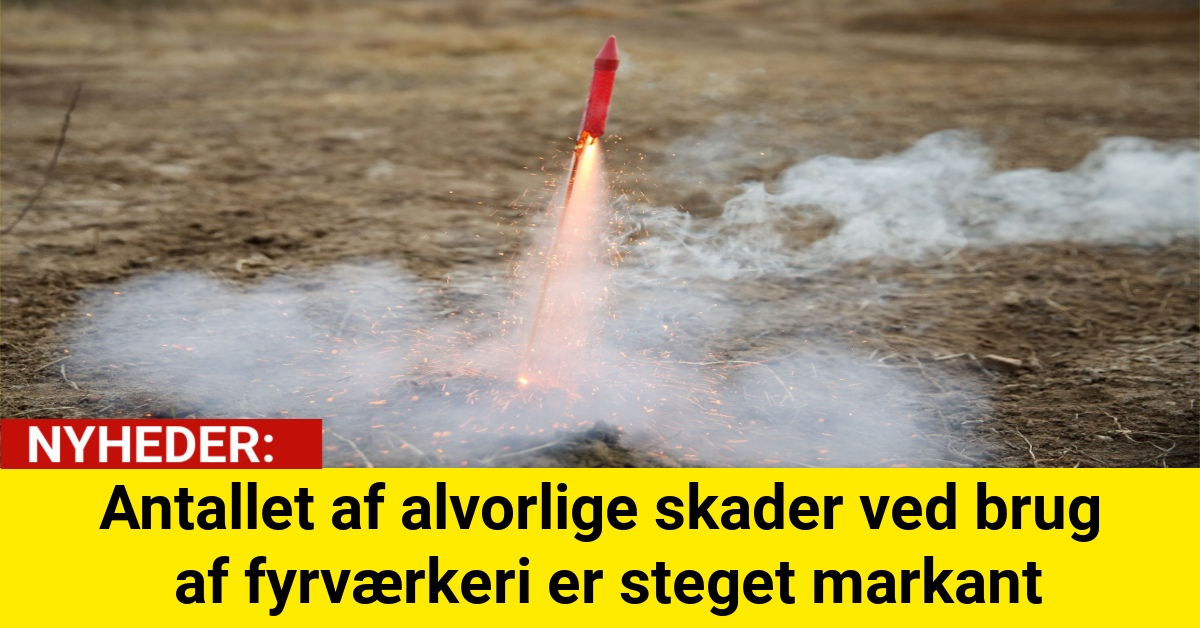 Antallet af alvorlige skader ved brug af fyrværkeri er steget markant