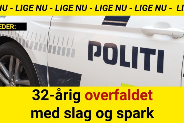 32-årig overfaldet med slag og spark