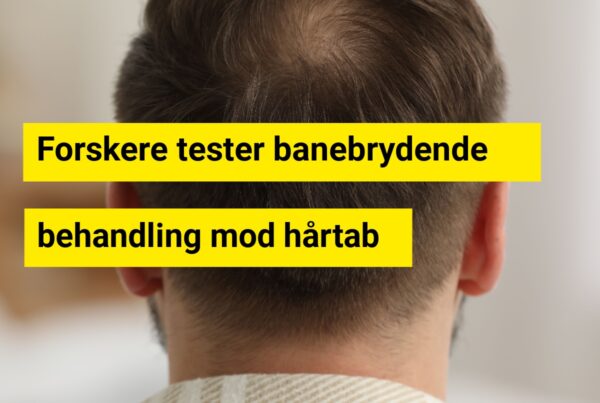 Forskere tester banebrydende behandling mod hårtab