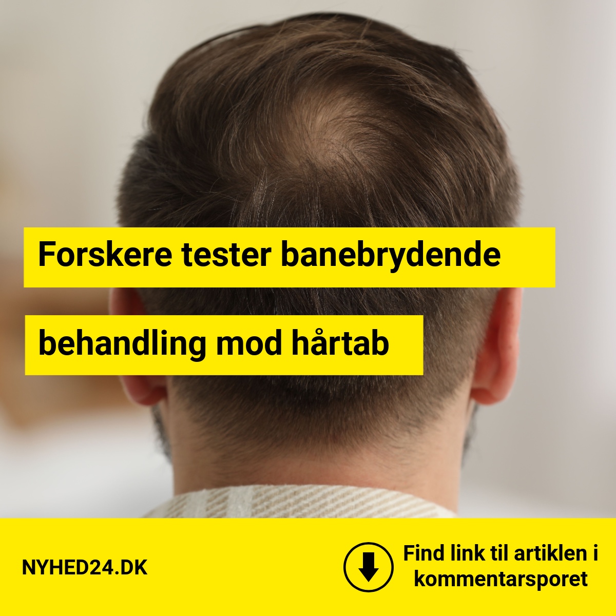 Forskere tester banebrydende behandling mod hårtab
