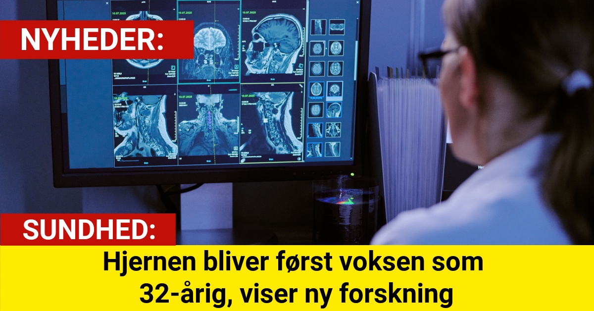 Forskerne overrasker: Din hjerne modnes langt senere end antaget