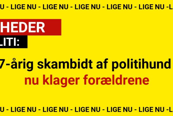 17-årig skambidt af politihund – nu klager forældrene