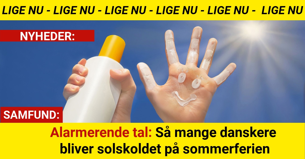 Alarmerende tal: Så mange danskere bliver solskoldet på sommerferien