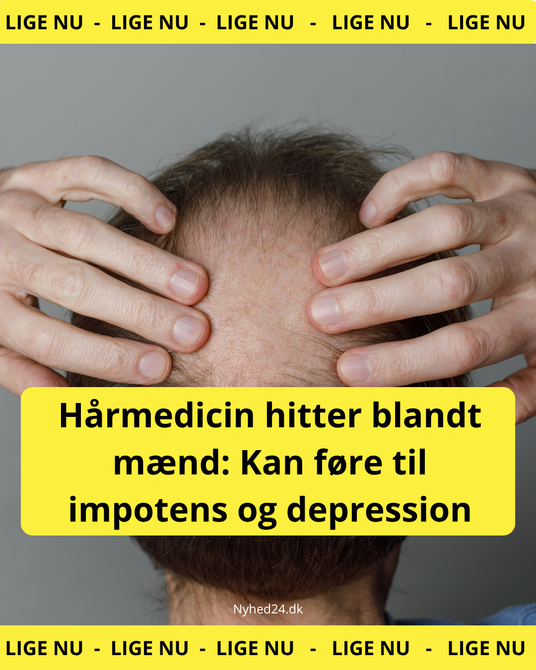 Hårmedicin hitter blandt mænd: Kan føre til impotens og depression
