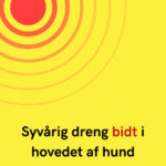 Syvårig dreng bidt i hovedet af hund