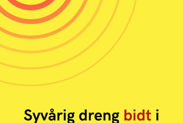 Syvårig dreng bidt i hovedet af hund