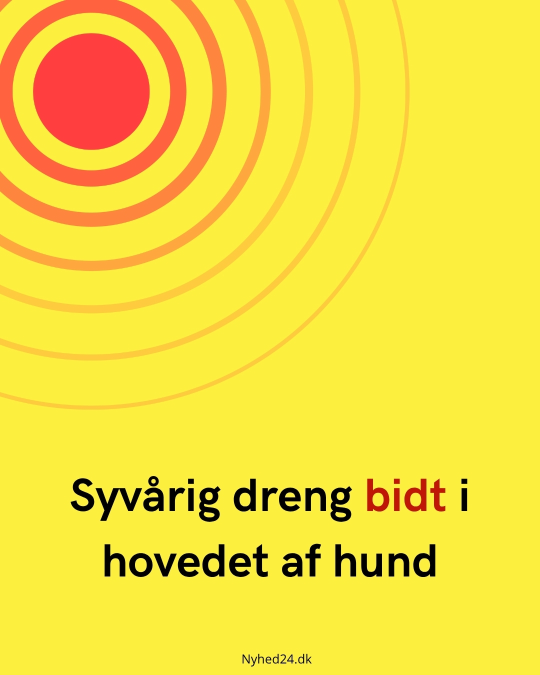 Syvårig dreng bidt i hovedet af hund
