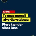 To unge mænd i alvorlig voldssag: Flere tænder slået løse
