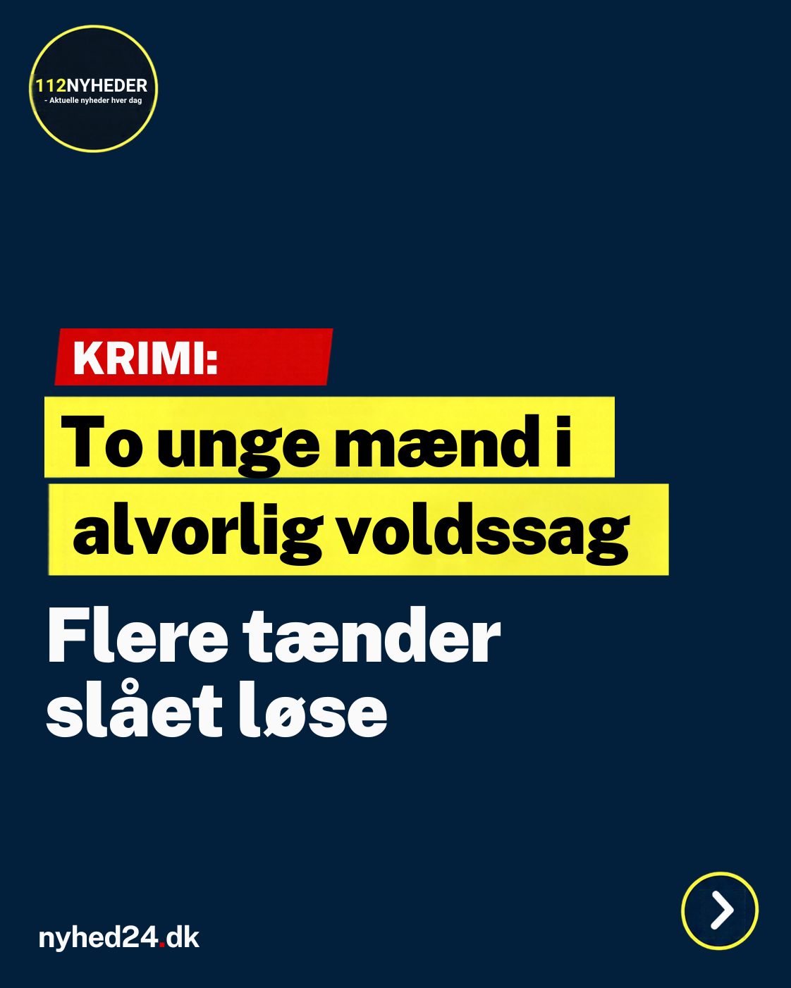 To unge mænd i alvorlig voldssag: Flere tænder slået løse